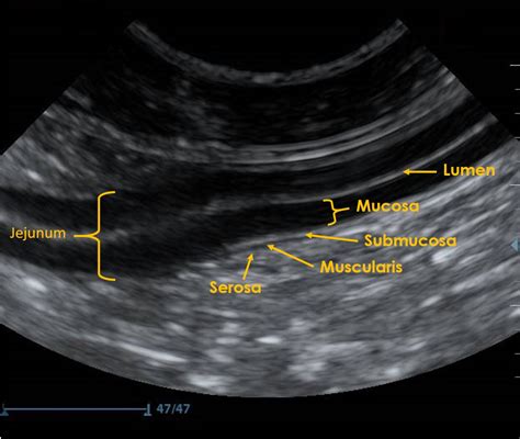 measurement of small intestine thickness cats|normal cat stomach ultrasound.